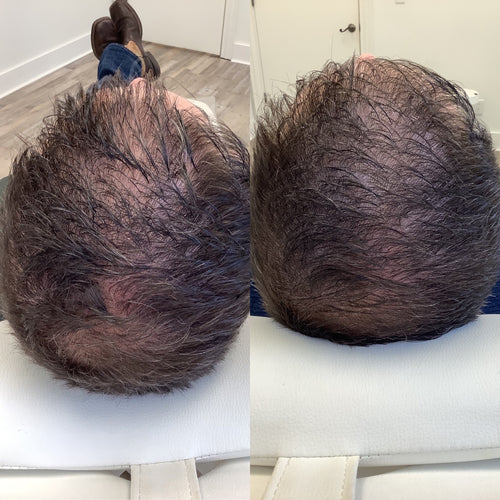 Scalp Treatments