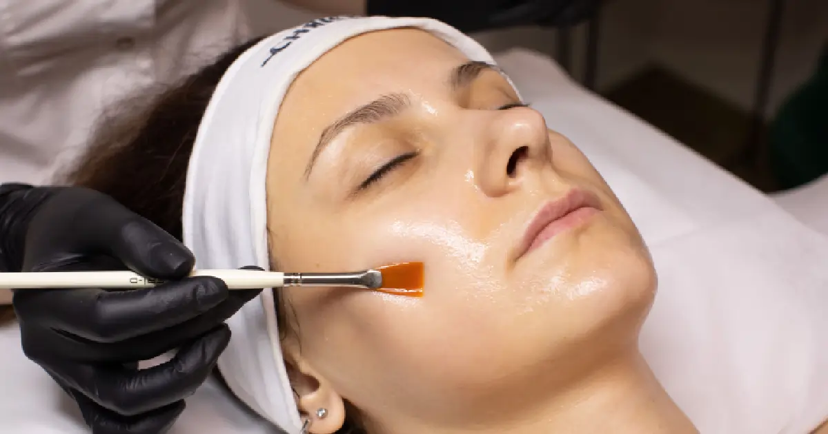 A woman receiving a professional Chemical Peel in Brentwood, TN, with a skincare specialist applying treatment solution using a brush