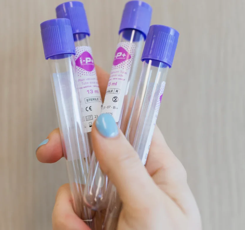 PRF Under Eye Injections